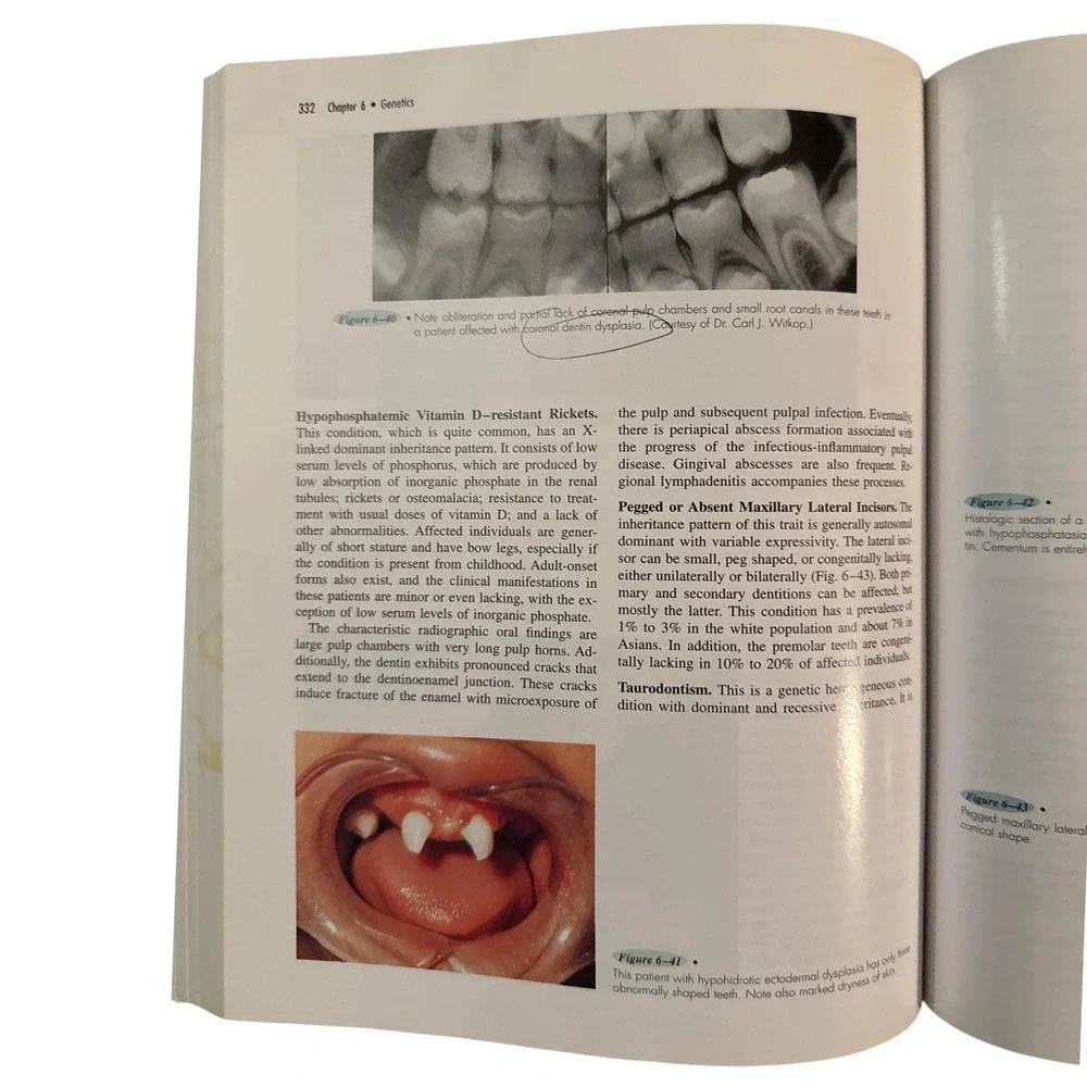 Oral Pathology for the Dental Hygienist Third Edition Textbook Ibsen Phelan